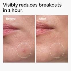 The Ordinary Sulfur 10% Powder-to-Cream Concentrate