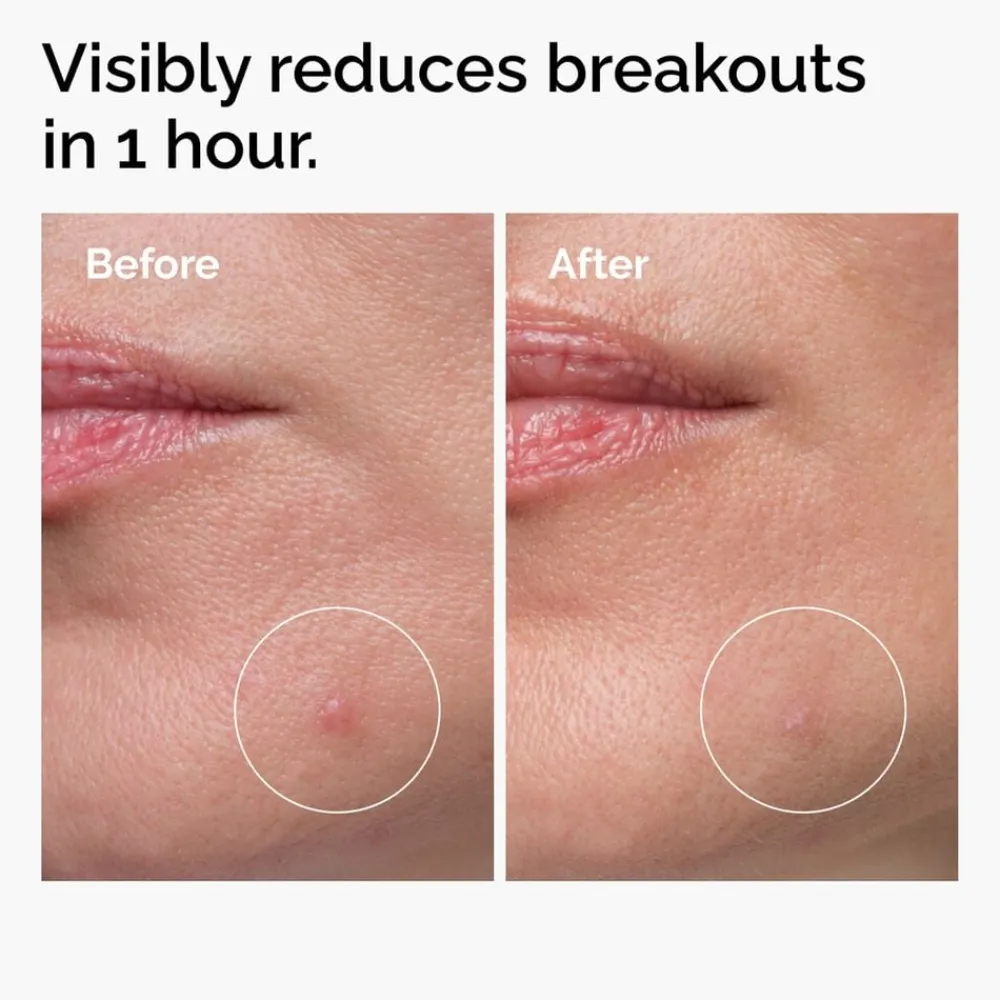 The Ordinary Sulfur 10% Powder-to-Cream Concentrate