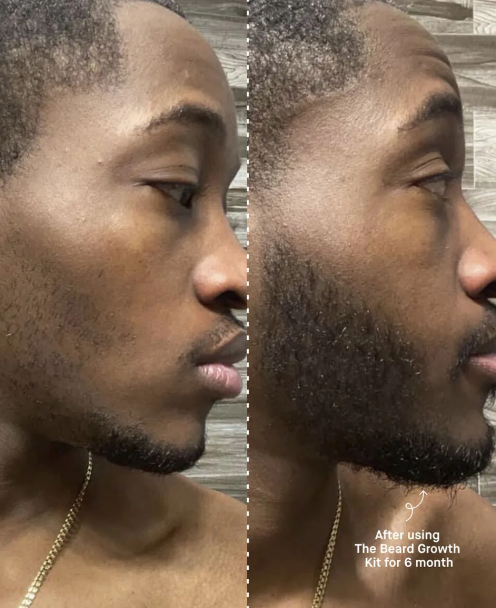 Copenhagen Grooming The Beard Growth Kit