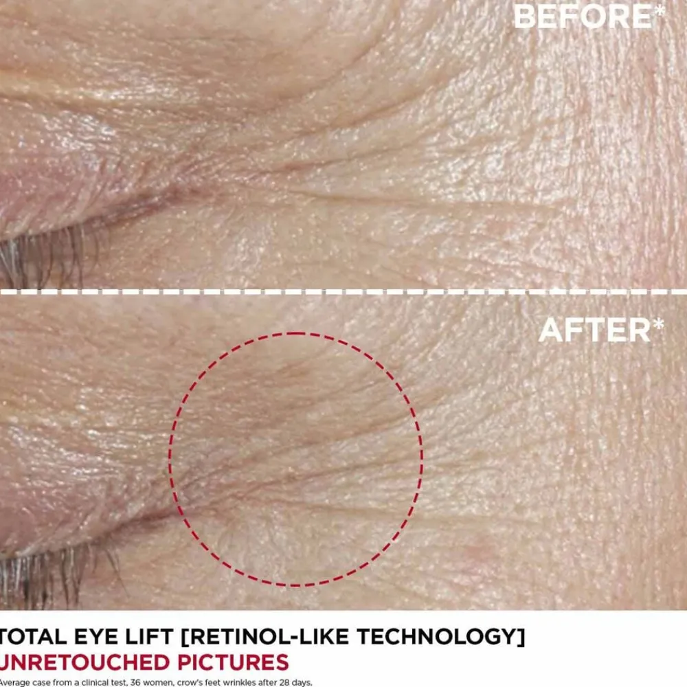 Total Eye Lift>Clarins Outlet